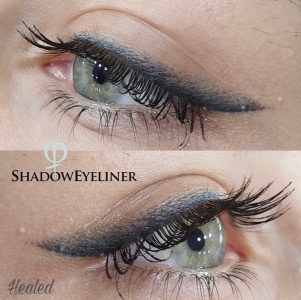 shadowliner